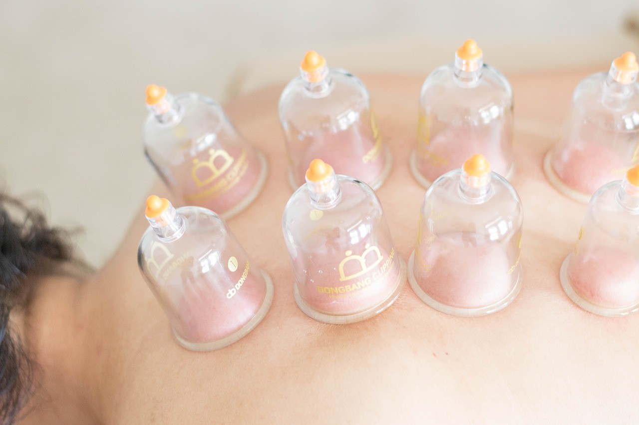 Cupping Therapy on Long Island